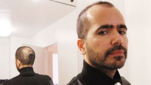 在后脑植入一架微型相机的纽约大学教授Bilal
